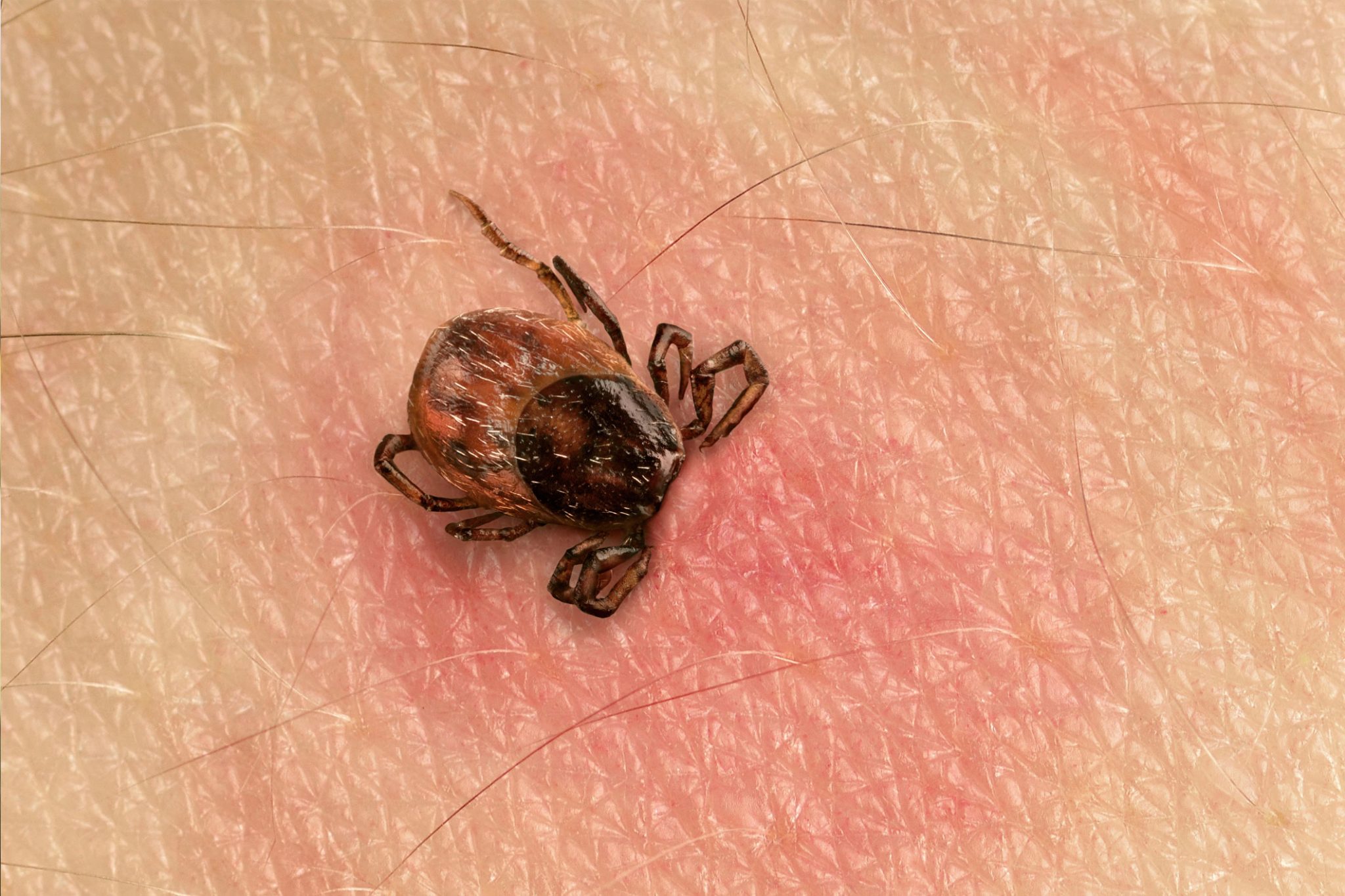 Image of Blacklegged Ticks that Spread Lyme Disease Still Active in Fall