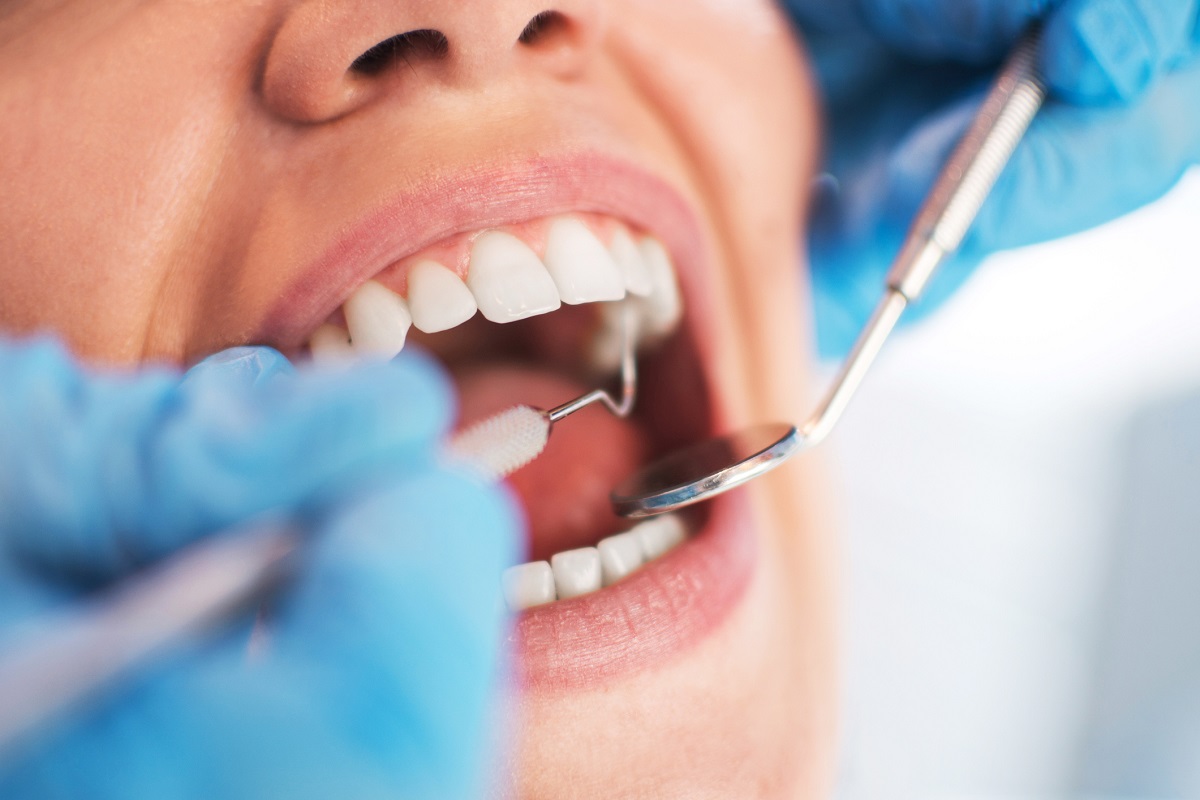 Image of Voters Urged to Make Filling the Gap in Dental Care a Provincial Election Issue