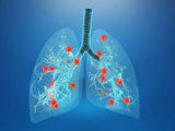 Illustration of lungs with virus